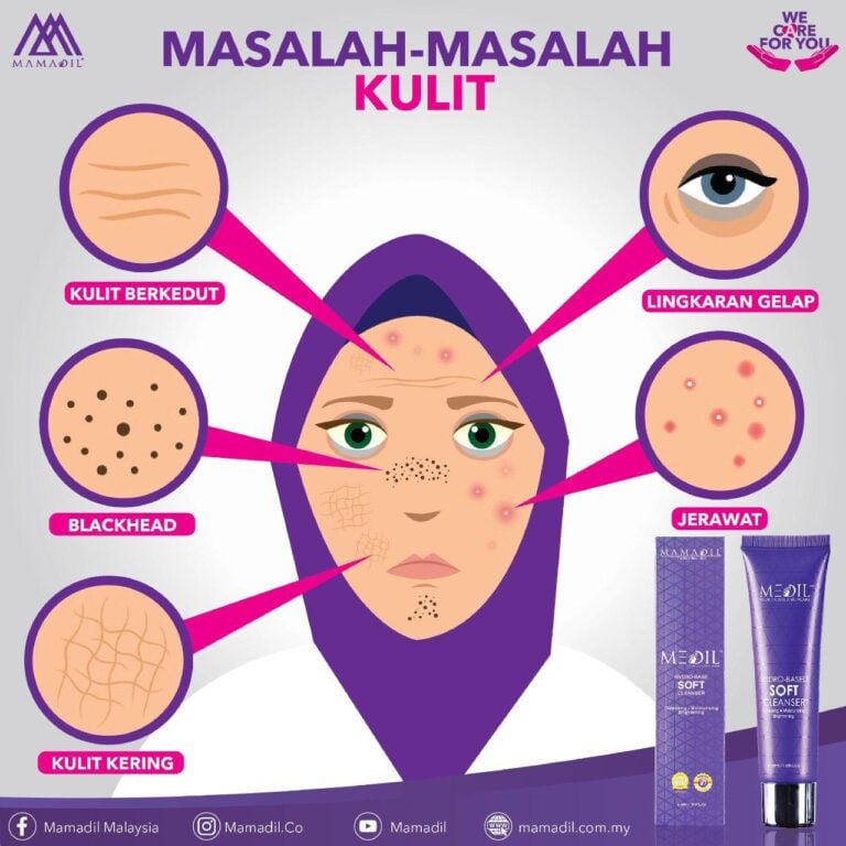 Sleeping Serum dapat atasi masalah-masalh kulit berikut