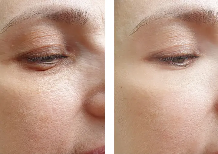 Mencegah penuaan dini kulit dengan  kolagen tripeptide