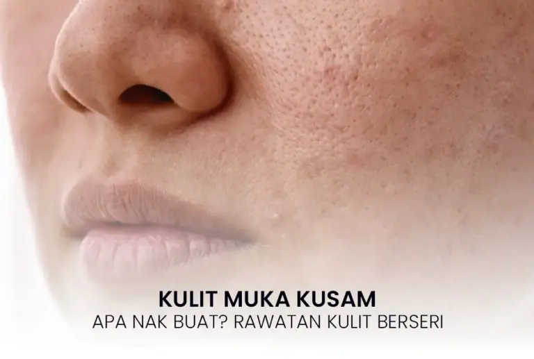 kulit muka kusam